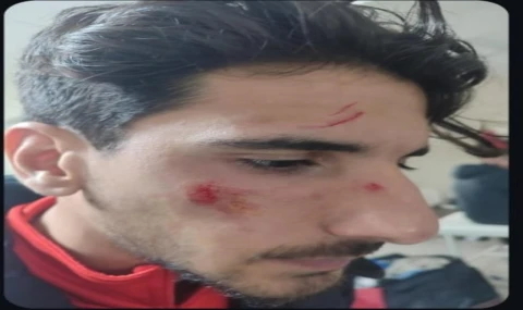 Viranşehir–Elazığ Yolspor Maçında Şiddet İddiası: Siverek Taraftarlarından Destek Açıklaması